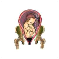 Complete Breech Presentation