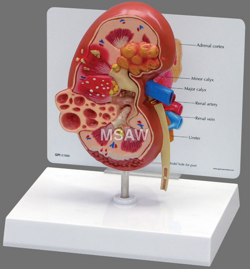 Human kidney Model