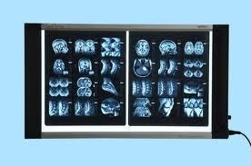 Thin LED X Ray View Box