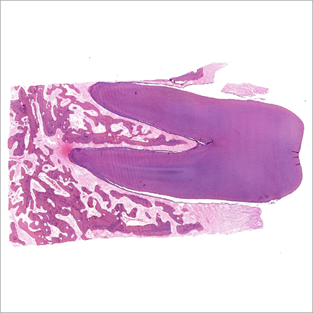 Bundle Bone Decalcified Tooth Section