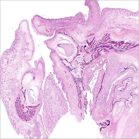 Face Development Sagittal Section