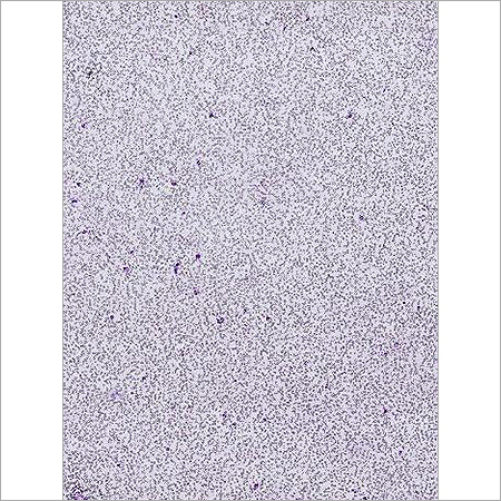 Peripheral Blood Smear