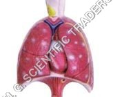 Human Lung With Heart, Larynx & Disphragm