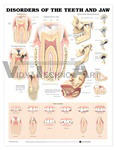 Disorders Of The Teeth And Jaw Anatomical Chart