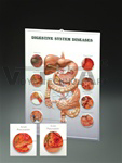 Digestive System Diseases 3D Lenticular Anatomical