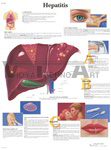 Hepatitis Chart