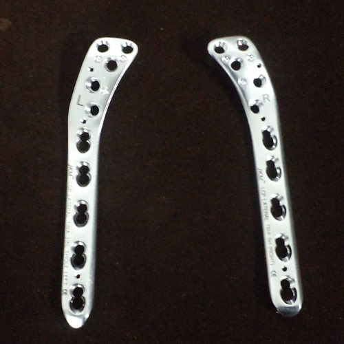 Lateral Tibia Locking Plates