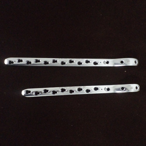 Proximal Femur Locking Plates