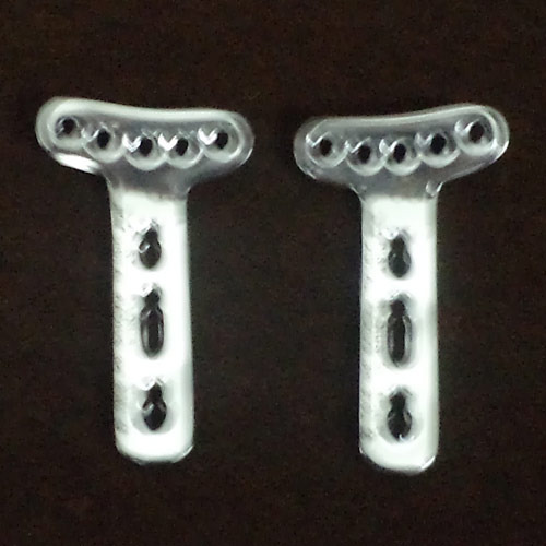 Distal Radius Locking Plates