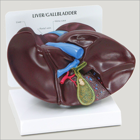 Liver with Gall Stones