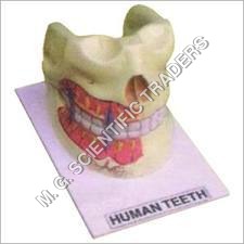 Human Teeth Model On Board