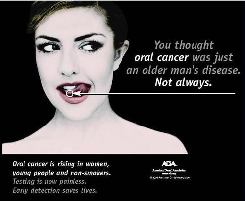 Oral Cancer Screening Services