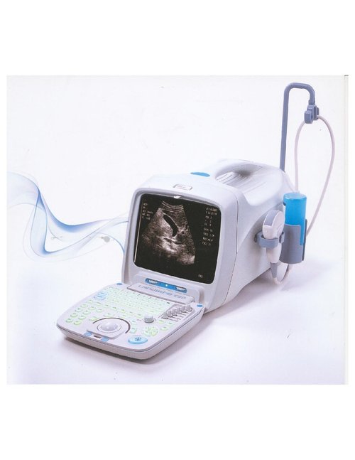 Fetal Monitor