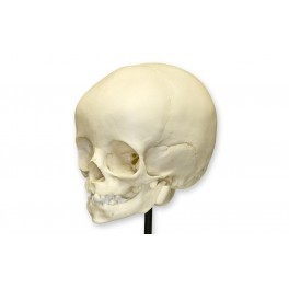 Foetal Child Skull (Infant Skull)
