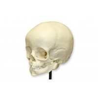 Foetal Child Skull (Infant Skull)