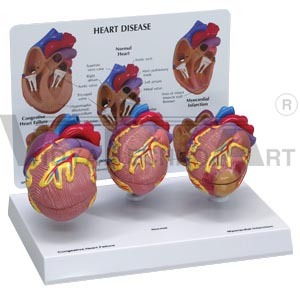 3-pc Mini Heart Set Models - High-quality Plastic, Approx. 50% Size, Base 8-3/4" X 6-1/4", Educational Card Included