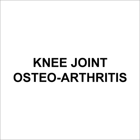 Knee Joint Osteoarthritis Treatment