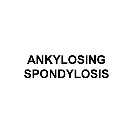Ankylosing Spondylitis Treatment