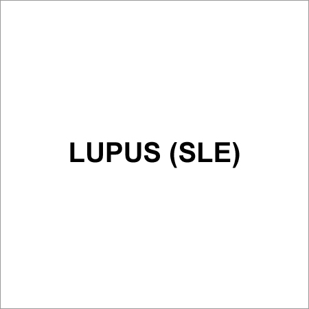 Autoimmune Disorder Treatment