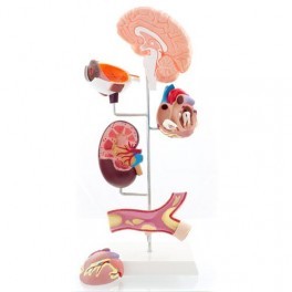 HYPERTENSION MODEL 6 PARTS