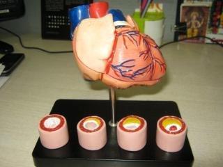 Heart Models