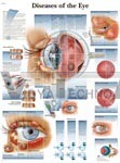 Diseases Of The Eye - Anatomical Chart