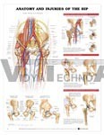 Anatomy And Injuries Of The Hip Anatomical Chart - Paper, 20"x26", White | Detailed Anatomy, Injury Visuals, Medical Reference