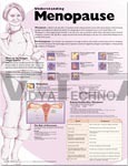 Understanding Menopause Anatomical Chart, 3rd Edition - Paper, 20"x26", Pink, Educational Guide on Symptoms and Health Maintenance