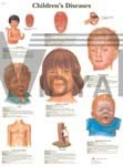Children's Diseases - Paper, 20 x 26 in, Multicolor | Visual Aid, Medical Education, Disease Identification