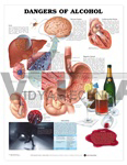 Dangers Of Alcohol Anatomical Chart, 1st Edition - Styrene Plastic