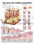 The Skin And Common Disorders Anatomical Chart - Recyclable Plastic, 20" x 26", Brown | Detailed Anatomy, Common Disorders, Educational Tool