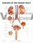 Diseases Of The Urinary Tract Anatomical Chart