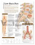 Understanding Low Back Pain Anatomical Chart 