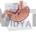 Click to Enlarge Stomach Anatomical Model Gastric Ulcer