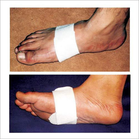 Metatarsal Support
