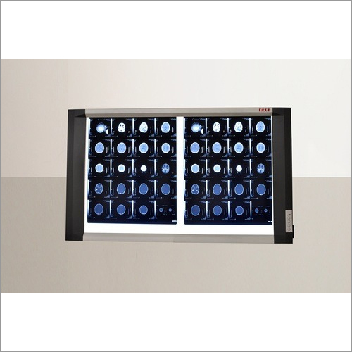 Double Screen Led X-Ray View Box