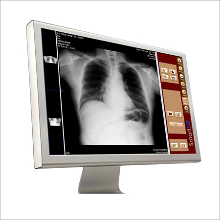 Portable X Ray View Box