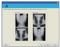 RPACS Stitch