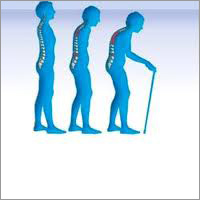 Calcium Citrate Tablets