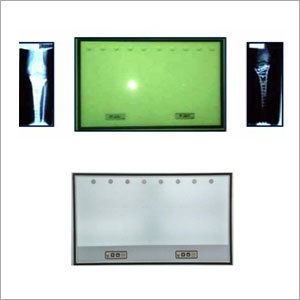 X-Ray View Box