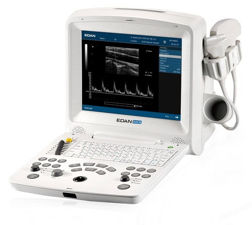 dan DUS 60 (Advanced Ultrasound with PW Doppler) - FDA and CE approved
