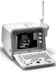 Edan DUS 6 Digital Diagnostic Ultrasound System (FDA and CE approved)