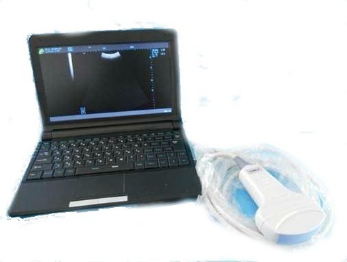 Portable Ultrasound Diagnostic Scanner - PO9