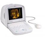 4D Ultrasound CTS-8800