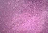 Pink Glitters