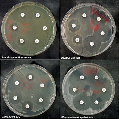 Antibiotic Sensitivity Testing Services