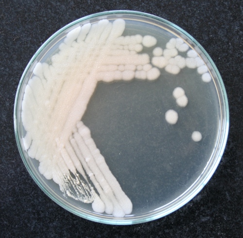 Sabouraud Dextrose Agar Sabouraud Dextrose Agar