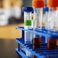 Pre treatments chemicals