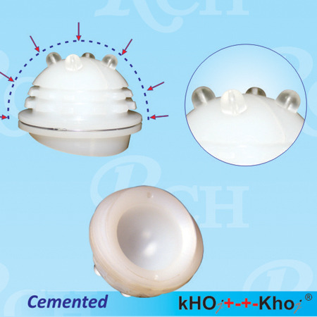 KHOJ +-+- KHOJ Modular Total Hip