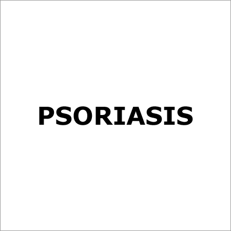 Psoriasis Treatment Services